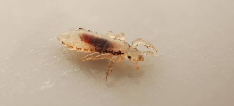 Kopflause Nissen Parasiten Am Kopf Ausfindig Machen Nyda